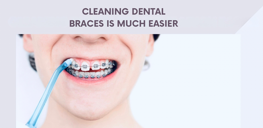 Simplify your dental braces cleaning